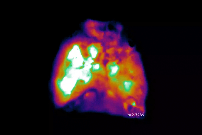 Moving image of brain cells firing in the brain of a mouse: different colored regions glow.