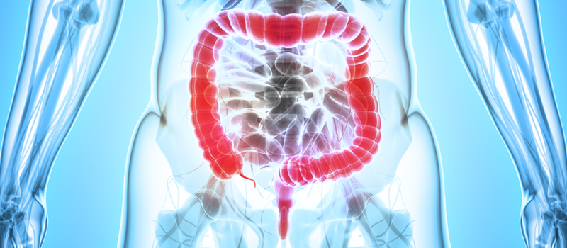 Graphic image showing large intesting lit up in red on a blue anatomical diagram.