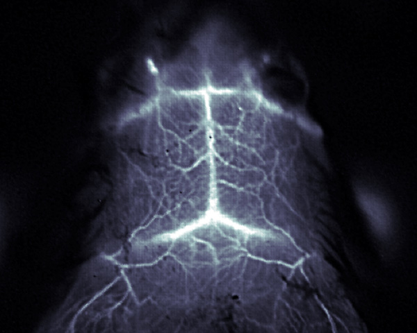 Image of a fluorescent mouse brain.