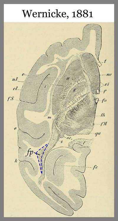 Carl Wernicke's diagram of brain.