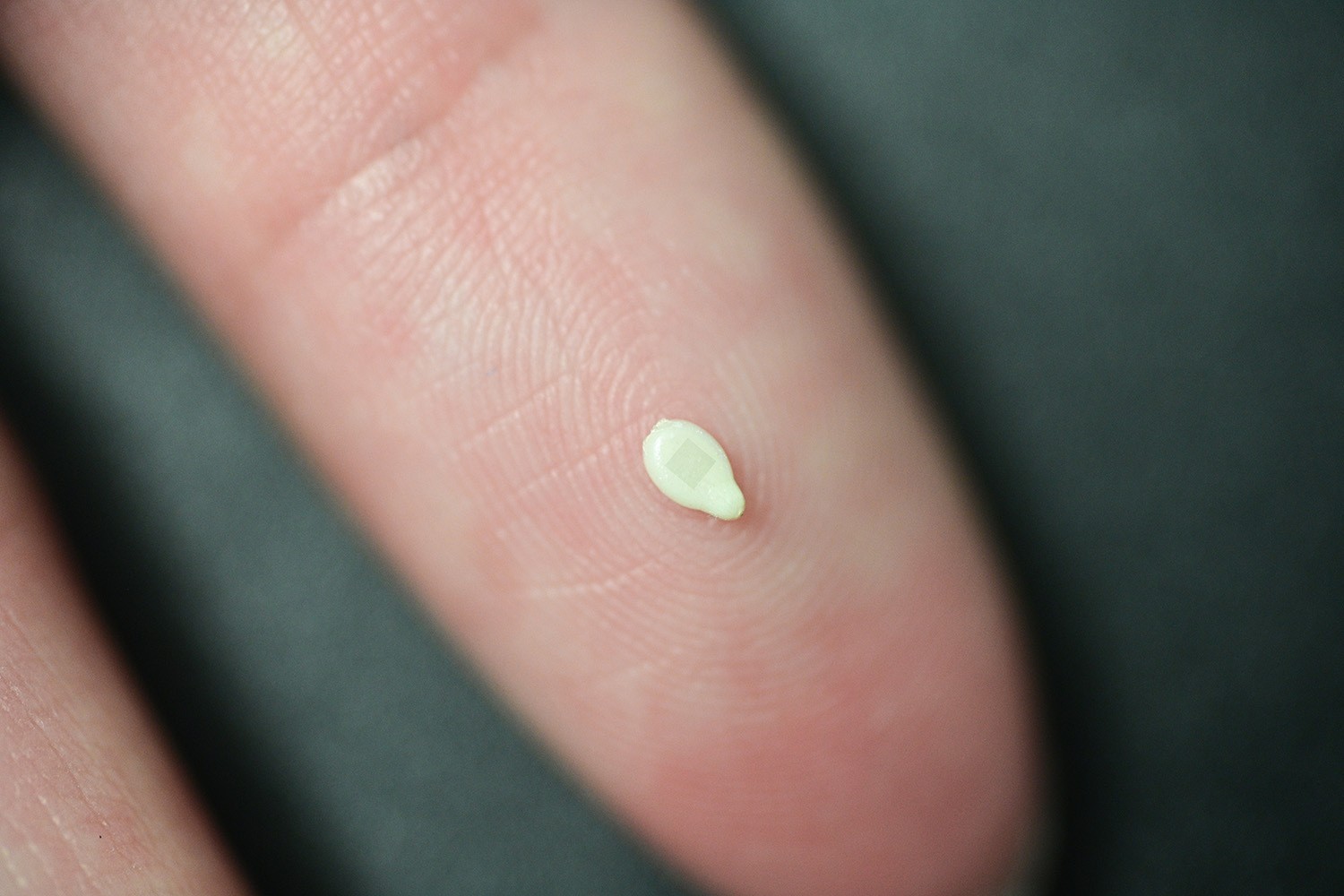 Photo of a person's fingertip with a sesame seed resting on it. There is a tiny patch on the body of the seed.
