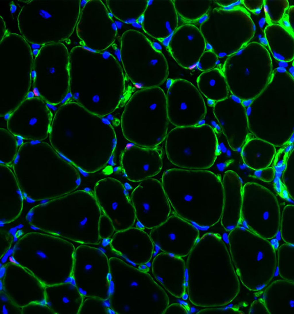 Image of a cross-section of regenerated muscle, showing muscle stem cells in red in their niche along the muscle fibers (shown in green). Blue dots indicate DNA in the nuclei of the fibers.