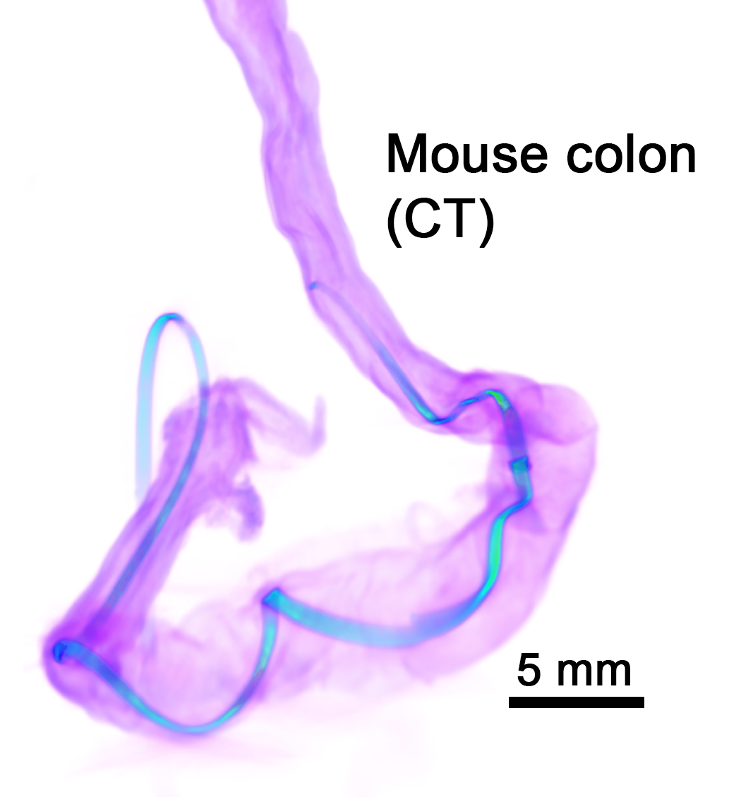 CT image of the probe, showing the probe in bright blue progressing in a corkscrew shape through the entirety of a bright purple translucent mouse colon that sits in a vaguely triangular shape on a white background.