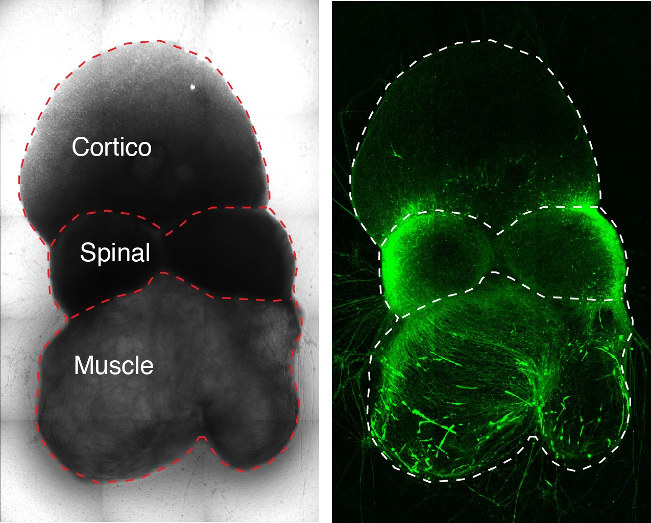 Image split into two sections: on the right, a glowing green body comprising three shapes, with a rounded one at the top, a band in the middle, and another rounded shape at the bottom. On the left, outlines of the shapes label them as "Cortico" at the top, "Spinal" in the middle, and "Muscle" at the bottom.
