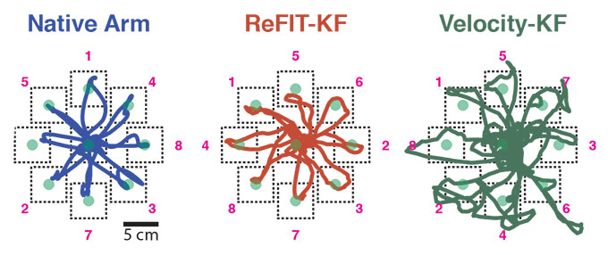 Diagrams tracing the accuracy of various trial scenarios of the ReFIT algorithm developed at Stanford.