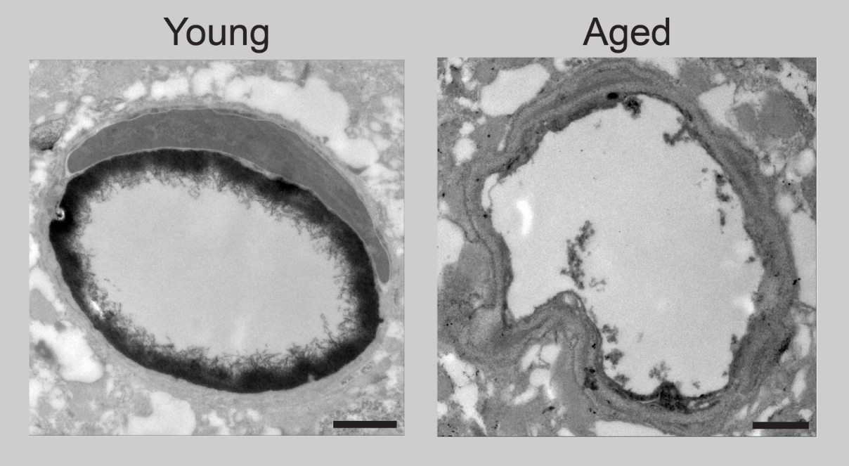 Grayscale medical scan of two images. Image on the left, labeled Young, shows a rounded cellular object with a thick, even border. Image on the right, labeled Old, shows a similar object with a lumpy, uneven, thinned out border.