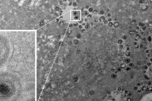 Microscope image of virus, showing virus cells in lighter gray against other cells.