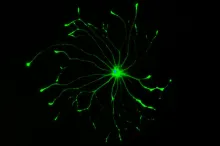 Image of an astrocyte cell lit up green.
