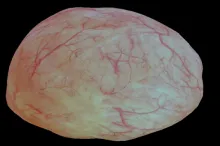 Screenshot from video of 3D bladder reconstruction.