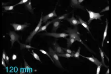 Image from video of cells being stimulated to activate kinases.