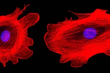 Confocal microscopy imaging of two cancer cells with cytoskeletal protein actin highlighted in red, showing structure.