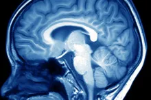 Imge of an MRI of a person's brain depicted in blue and white.