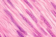 Image of muscle cells showing how long and striated they are.