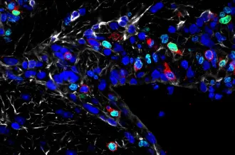 Microscope image of numerous cells, most of them dark blue.