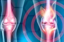 Graphic 3d image showing person's knees, with one circled in red, against abstract background.