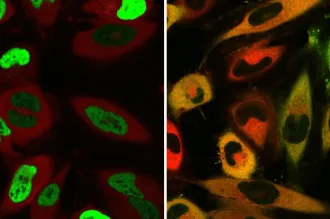 Image showing cells, with left side showing more green glowing cells and the right showing more cells that are not glowing green.