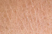 Photo of human skin.