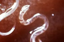 Photo of parasite worms.