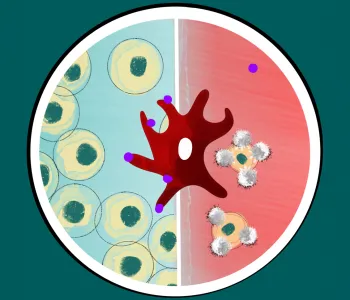 Graphic image of a circle with two sides, the left side blue with cells in it, the right side red with cells being attacked by T cells. A large amorphous red cell sits on the center line of hte circle with purple dots on the blue half-circle side.