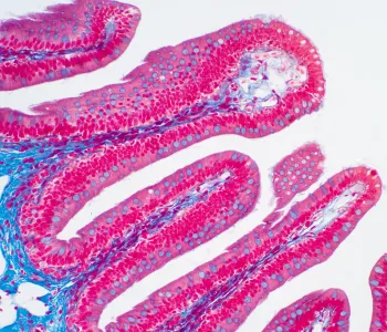 Image of villi cells in bright pink and blue on a white background.