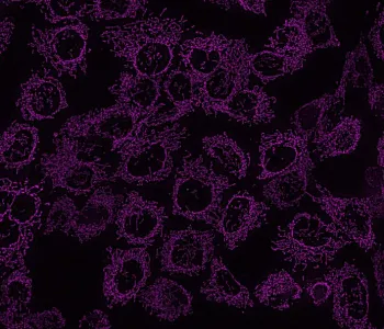 Image of numerous round purple shapes on a black background.