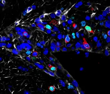 Microscope image of numerous cells, most of them dark blue.