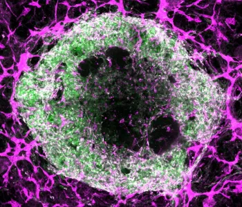 Image of a green and white cell surrounded by a web of purple lines.