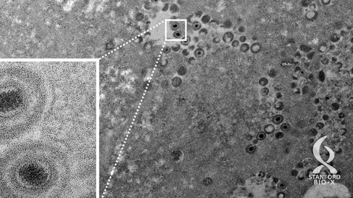 electron microscope images virus