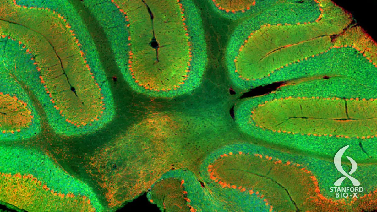 cerebellum_banner.webp?orig=png