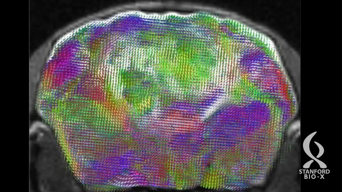 Stanford Medicine team creates advanced model for studying brain