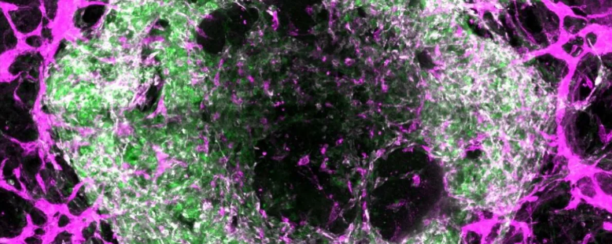 Image of a green and white cell surrounded by a web of purple lines.