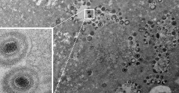 Microscope image of virus, showing virus cells in lighter gray against other cells.
