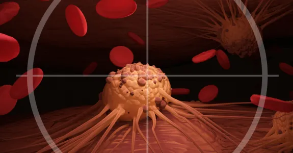 Graphic image of cancer cell in crosshairs.