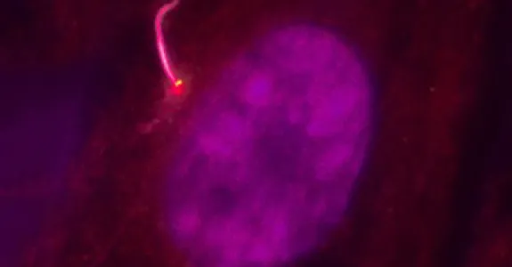 Photo of a retinal pigmented epithelial cell, with the nucleus in magenta and cilium in pink.