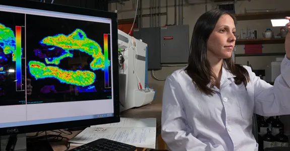 Photo by L.A. Cicero of Livia Eberlin, a postdoctoral scholar in chemistry, examines a stained sample against a backdrop of images from gastric cancer surgery and the mass spectrometer she uses in her interdisciplinary research.