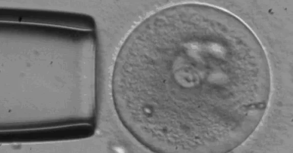Photo of embryo and pipette.