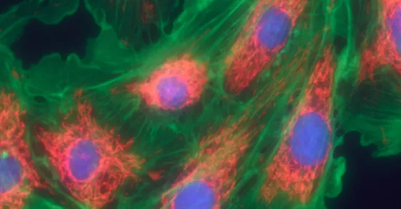 Graphic image of fibroblast cells with cell components colored.