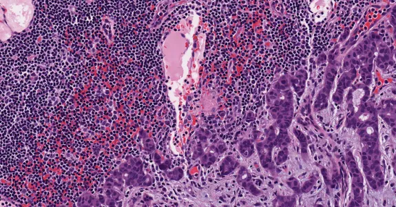 Graphic image of cells preserved in formaldehyde.