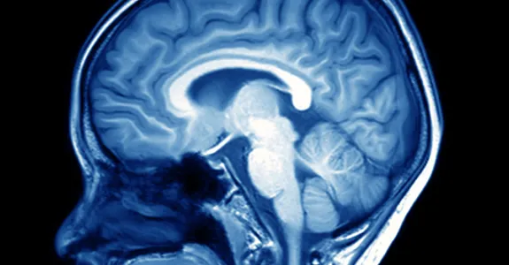 Imge of an MRI of a person's brain depicted in blue and white.