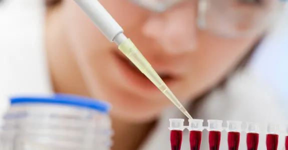 Photo of researcher testing blood samples.