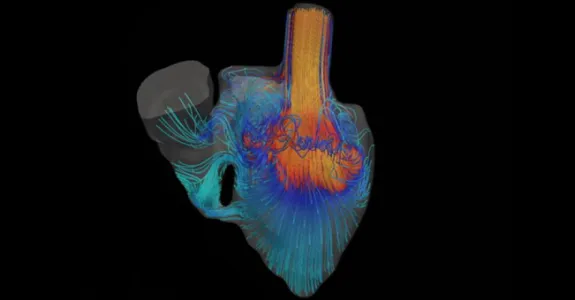 Graphic image of Dr. Marsden's blood flow simulator, showing colorful simulated flows moving through a heart.