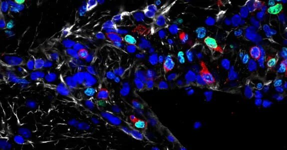 Microscope image of numerous cells, most of them dark blue.