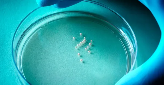Photo showing tiny white spheres in a petri dish, which are the developing organoids.