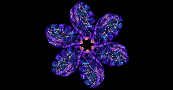 Image of 5 scans from Bellymount, each "petal"-shaped, arranged into a flower. Scans show organs, vessels, and other features, brightly colorized.