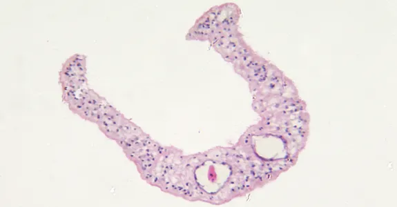Image of Schistosoma mansonii parasite.