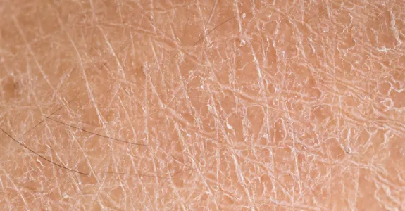 Photo of human skin.