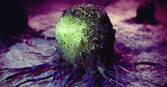 Graphic illustration of cancer cell indicated in green, against a purple background.