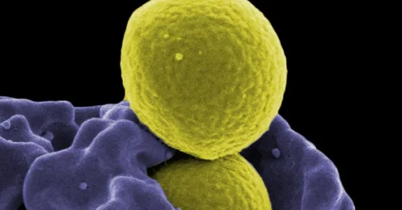 Image of a macrophage ingesting bacteria.