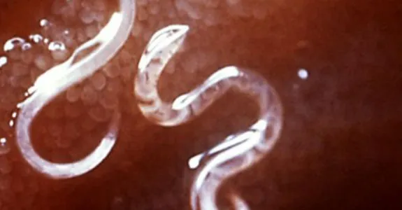 Photo of parasite worms.