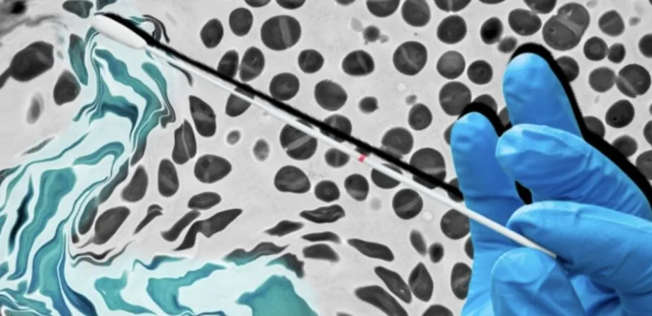 Composite graphic image showing a gloved hand swabbing a turquoise and white fluid over a background of black-and-white bacterial cells